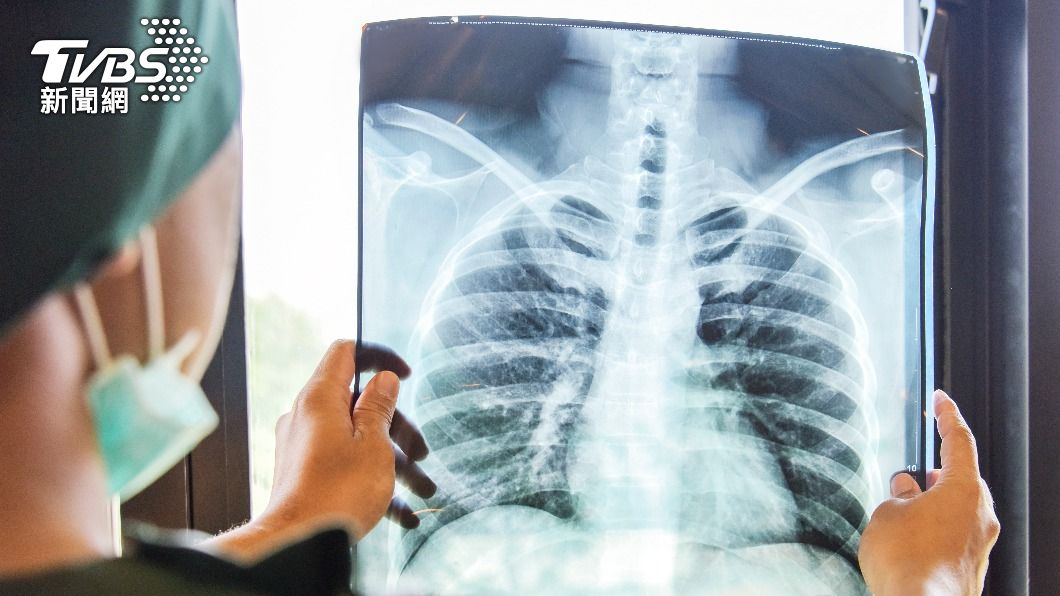 Taiwan Cancer Moonshot project reveals cancer insights (Shutterstock)