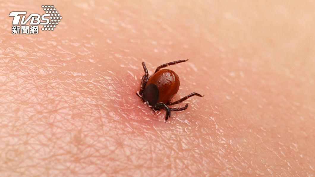 Taiwan confirms first imported Lyme disease case of 2024 (Shutterstock)