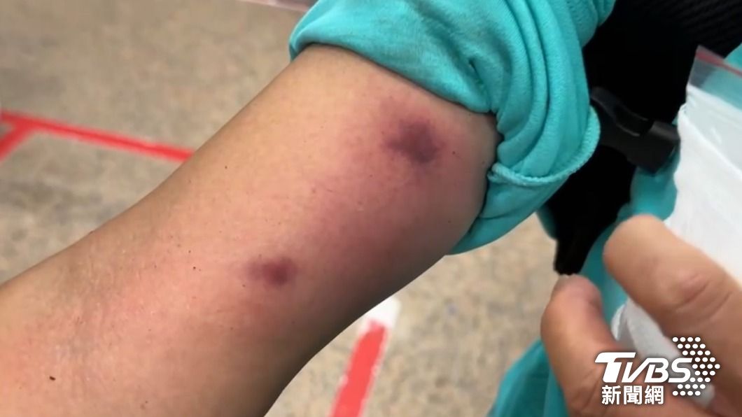 Five hikers stung by bees in northern Taiwan, one in ICU (TVBS News)
