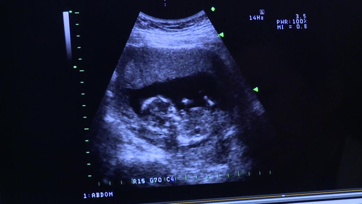 Taiwan’s surrogacy debate pits ethics against birth crisis